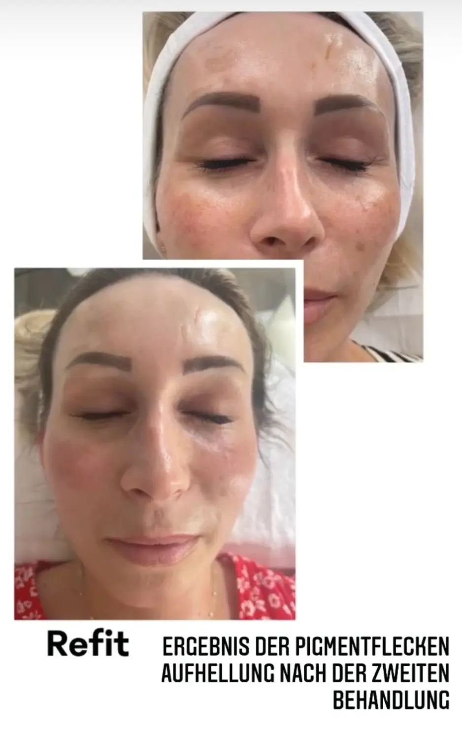 BEAUTY NAILS DELUXE - refit